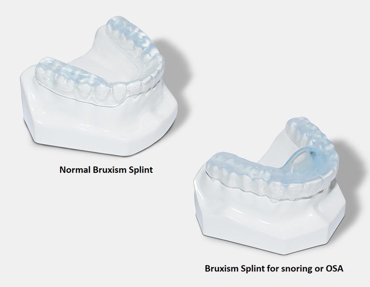 oral appliance therapy Melbourne treat bruxism